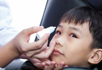 Симптомы и лечение аллергического конъюнктивита у ребенка Аллергический конъюнктивит причины у детей