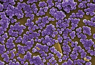 Признаки и виды бактериальной инфекции – диагностика и лечение заболеваний